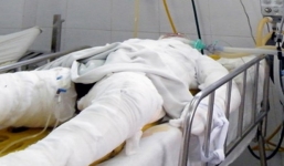 Tán em gái người tình không được, dùng xăng đốt nạn nhân