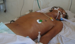 3 người trong tình trạng nguy kịch vì ăn nhộng ve sầu