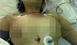 Thêm hai nạn nhân chết tức tưởi dưới tay 'lang vườn'