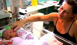 Bé sơ sinh có hai khuôn mặt, hai đầu, hai bộ não