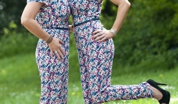 Cặp song sinh nghiện phẫu thuật thẩm mỹ để giống nhau như đúc