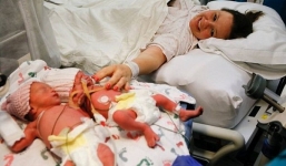Xúc động hình ảnh cặp song sinh nắm chặt tay nhau khi chào đời