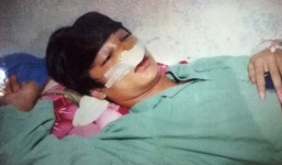 Học sinh lớp 11 tố bị CSGT đánh vỡ xương mũi