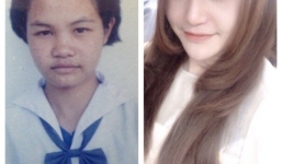 Bị từ chối lời cầu hôn vì quá xấu, cô gái quyết phẫu thuật thành thiên nga