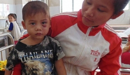 Bé trai ba tuổi bị cha dượng đánh đập dã man