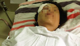 Phụ nữ bị hàng chục thanh niên giẫm đạp vì can ngăn đánh nhau