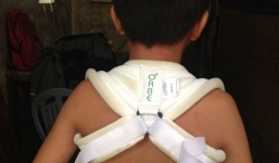 Phẫn nộ nam thanh niên đánh cậu bé 13 tuổi bị thương