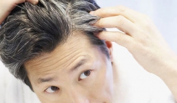 Vì sao tóc chúng ta lại bị... bạc? 