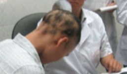 Bị tai nạn không chết, lông tóc tự nhiên rụng hết