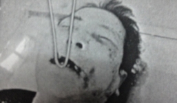 Phát hiện người đàn ông chết bất thường giữa khu trung tâm xã