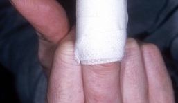 Bị chó cắn đâm đơn kiện đòi bồi thường hai triệu tỷ tỷ tỷ USD