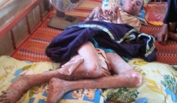 Người đàn ông 9 năm sống trong hình hài 'bò sát'