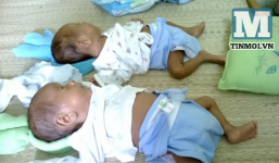 Bố nghèo, mẹ bỏ đi, cặp song sinh khát sữa thoi thóp giành sự sống