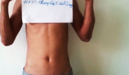 Côn đồ xông vào nhà nghỉ chém người