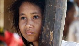 Cuộc sống bí ẩn của cô gái 'nửa người nửa thú'