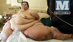 Cái chết bí ẩn của người đàn ông béo nhất thế giới