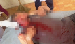 Hà Nội: Đi đánh cá bị hành hung dã man, vứt xuống sông Hồng