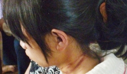 Bị mẹ ruột hành hạ dã man, thiếu nữ uống thuốc tự tử