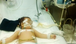 Một cháu bé nguy kịch vì uống nhầm dầu luyn