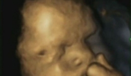 Bất ngờ với hình ảnh thai nhi suy tư trong bụng mẹ