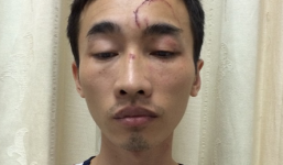 Gã trai chuyên rình phụ nữ tắm để trộm iPhone