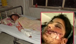 Thiếu nữ bị gia đình bắn, ném xuống cống vì kết hôn với người mình yêu