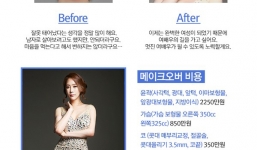 Cận cảnh 85 ngày phẫu thuật chuyển giới của một chàng trai