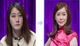 Cận cảnh 85 ngày phẫu thuật chuyển giới của một chàng trai