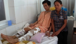 Tai nạn thảm khốc ở Thái Lan: Phút trườn ra khỏi xe phát nổ với cái chân bị gãy làm 3