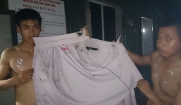 Hàng chục người bỏng nặng, quần áo cháy xém vì xe axit