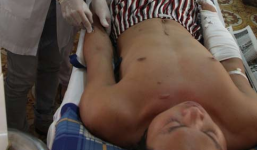 Hơn 20 thanh niên hỗn chiến, 1 người bị bắn trọng thương