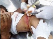 Bé gái 14 tháng tuổi bị chém trọng thương vì khoản nợ của cha