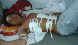 Bị đâm nhiều nhát vào người vì lỡ ném dép vào đầu bạn