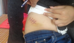 Sếp nữ cầm kéo đâm nhân viên nhập viện