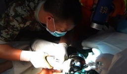 Người đàn ông Trung Quốc mắc kẹt “của quý” hai ngày trong ống nước 