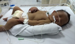 Bất đồng nhóm máu với mẹ, một trẻ sơ sinh suýt chết