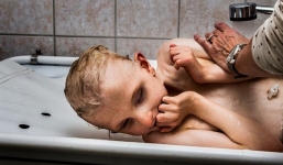 Bộ ảnh giàu xúc cảm về cậu bé không có mắt