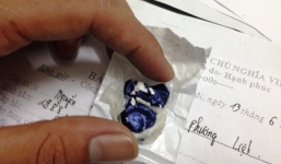 Dán ma túy vào trong áo vẫn không “thoát lưới” 141 