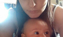 Phẫu thuật cắt bỏ buồng trứng, phát hiện có thai 32 tuần