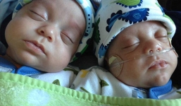 Hy hữu: Cặp song sinh chào đời cách nhau gần 40 ngày