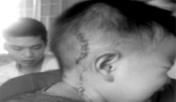 Bố mâu thuẫn tiền bạc, con 14 tháng bị chém 