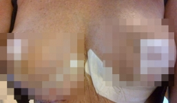 Ngực khủng của quý bà bỗng dưng...nổ tung