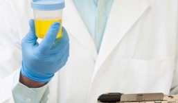 Phát hiện những bệnh nguy hiểm qua nước tiểu hàng ngày