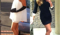 Nữ sinh dùng 350 triệu tiền học phí để phẫu thuật thẩm mỹ