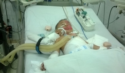 Hai trẻ đuối nước bị bỏ vào lu rồi hơ trên lửa