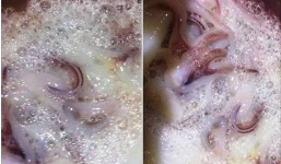Hoảng hốt mực sủi bọt như tắm xà phòng
