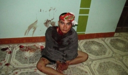 Cuộc đào tẩu bất thành của những tên trộm chó