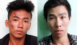 Cô gái trẻ ngã đập đầu xuống đường, chấn thương sọ não vì bị cướp