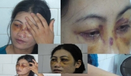 Vụ chồng bắt vợ con ăn phân: Đêm kinh hoàng của cậu con trai