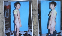 Mẹ kế đánh con chồng bầm dập, đánh chồng khâu 50 mũi